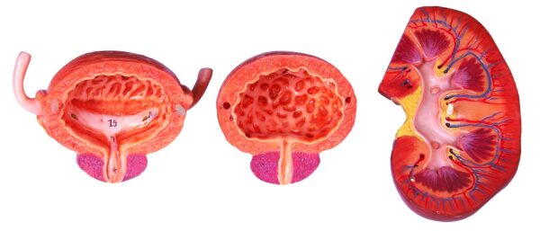 HUG/A14004 - układ moczowy