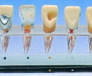 HUG/B10015/1 – model kliniczny chorób endodontycznych