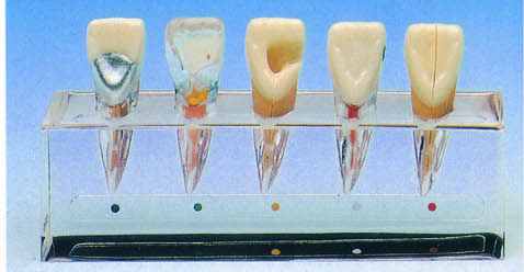 HUG/B10015/1 - model kliniczny chorób endodontycznych