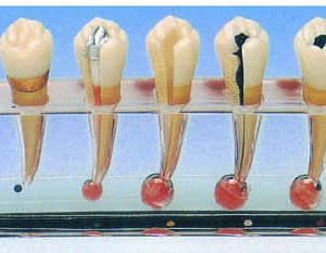 HUG/B10015/2 – model kliniczny chorób endodontycznych