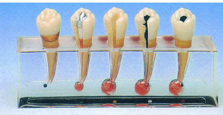 HUG/B10015/2 - model kliniczny chorób endodontycznych